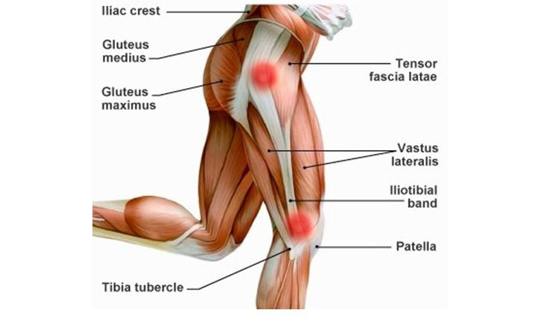 Har du fått Runners knee (løperkne)? Dette er mine anbefalinger.